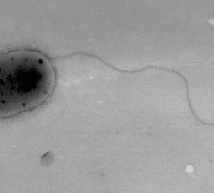Methylobacteriaceae, Aslam Z., Lee C. S., Kim K.-H., Im W.-T., Ten L. N., Lee S.-T. via Wikipedia, Big think