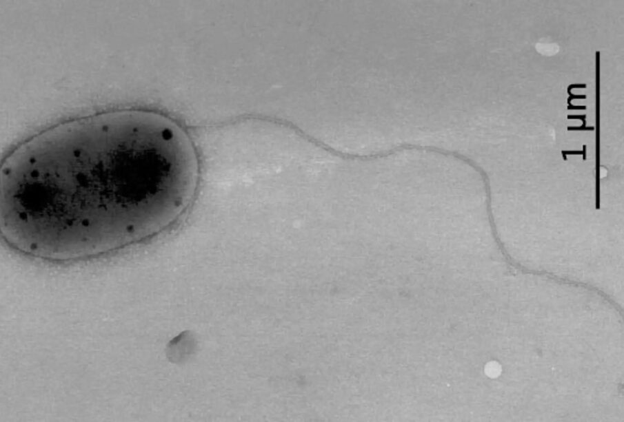 Methylobacteriaceae, Aslam Z., Lee C. S., Kim K.-H., Im W.-T., Ten L. N., Lee S.-T. via Wikipedia, Big think